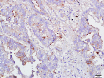 IFN gamma Rabbit Polyclonal Antibody