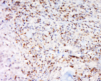 IGFBP5 Rabbit Polyclonal Antibody