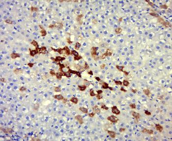 IL18 Rabbit Polyclonal Antibody