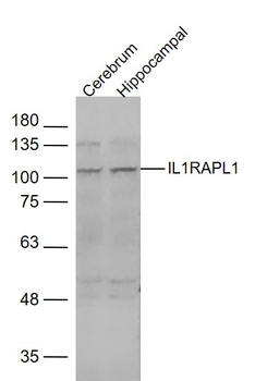 IL1RAPL1 Rabbit Polyclonal Antibody