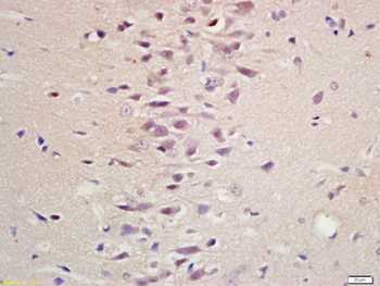 IL1RAPL1 Rabbit Polyclonal Antibody