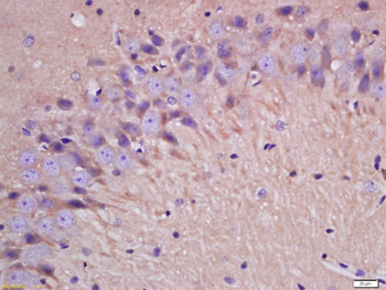 IL-1 Beta Rabbit Polyclonal Antibody