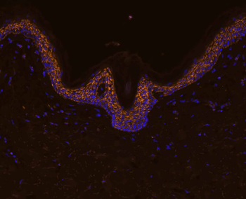 IL-8/CXCL8 Rabbit Polyclonal Antibody