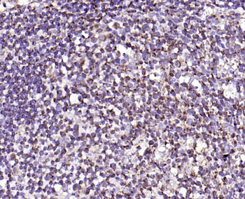 IL-8/CXCL8 Rabbit Polyclonal Antibody