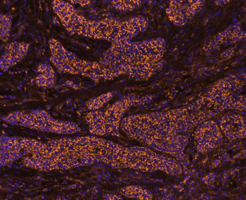 IL-8/CXCL8 Rabbit Polyclonal Antibody