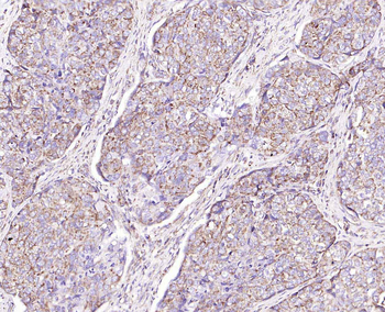 IL-8/CXCL8 Rabbit Polyclonal Antibody