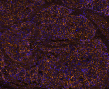 IL-8/CXCL8 Rabbit Polyclonal Antibody