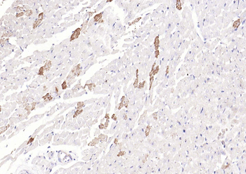 ILK-1 Rabbit Polyclonal Antibody