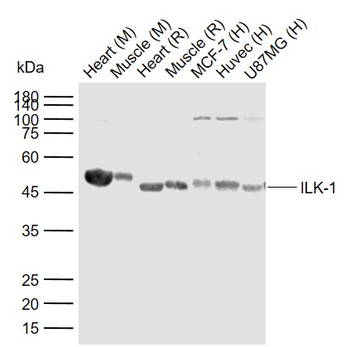 ILK-1 Rabbit Polyclonal Antibody