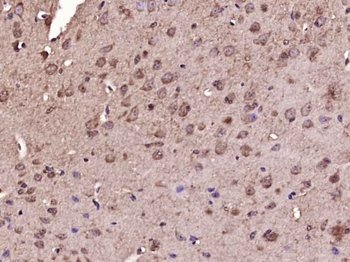 Inhibin Alpha Rabbit Polyclonal Antibody