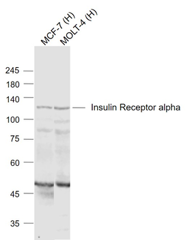 Insulin Receptor alpha Rabbit Polyclonal Antibody