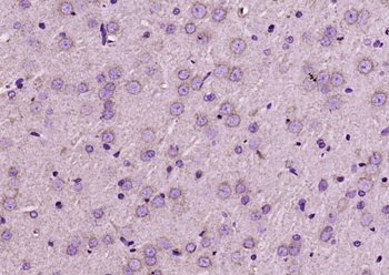 Integrin Alpha 3 + Beta 1 Rabbit Polyclonal Antibody