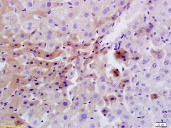 Insulin Receptor Rabbit Polyclonal Antibody