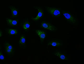 Insulin Receptor Beta Rabbit Polyclonal Antibody