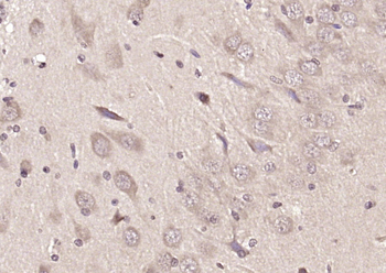 HEBP1 Rabbit Polyclonal Antibody