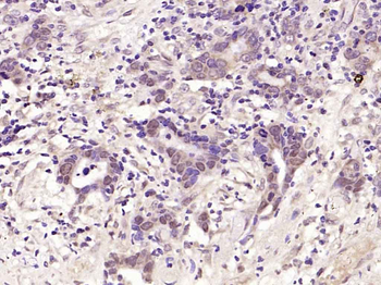 Phospho-JNK1 + 2 + 3 (Thr183+Tyr185) Rabbit Polyclonal Antibody