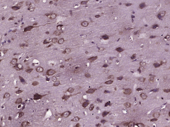 Phospho-JNK1 + 2 + 3 (Thr183+Tyr185) Rabbit Polyclonal Antibody