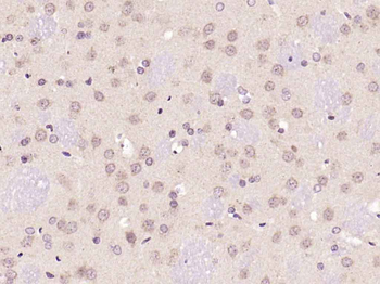 Phospho-JNK1 + 2 + 3 (Thr183+Tyr185) Rabbit Polyclonal Antibody