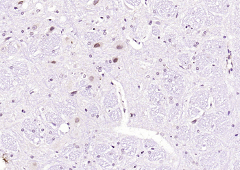 Phospho-JNK1 + 2 + 3 (Thr183+Tyr185) Rabbit Polyclonal Antibody