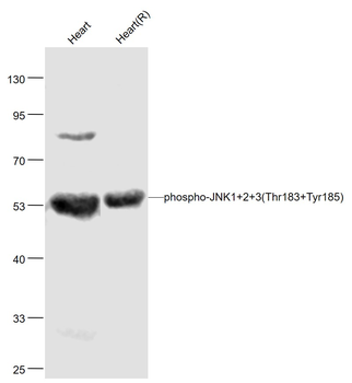 Phospho-JNK1 + 2 + 3 (Thr183+Tyr185) Rabbit Polyclonal Antibody