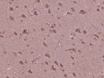 Phospho-JNK1 + 2 + 3 (Thr183+Tyr185) Rabbit Polyclonal Antibody