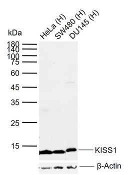 KISS1 Rabbit Polyclonal Antibody