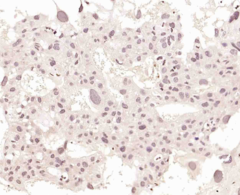 KLF6 Rabbit Polyclonal Antibody