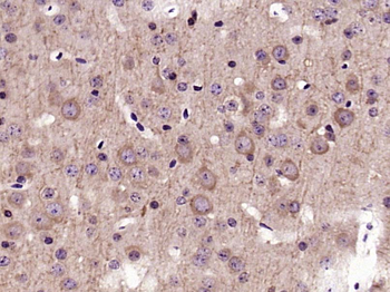 KRAS Rabbit Polyclonal Antibody