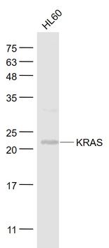 KRAS Rabbit Polyclonal Antibody
