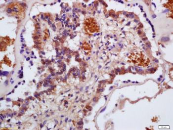 Hemoglobin alpha Rabbit Polyclonal Antibody