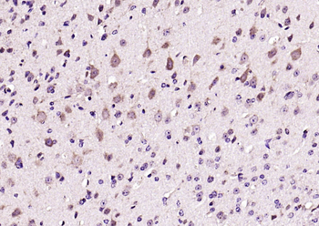 Leptin Rabbit Polyclonal Antibody