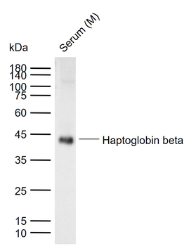 Haptoglobin beta Rabbit Polyclonal Antibody