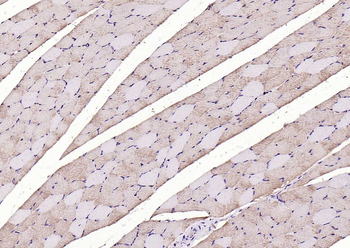 LIFR Rabbit Polyclonal Antibody