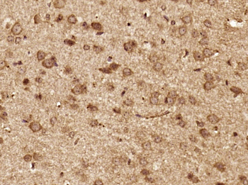 LIS1 Rabbit Polyclonal Antibody