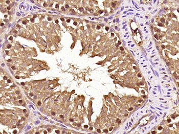 LIS1 Rabbit Polyclonal Antibody
