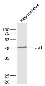 LIS1 Rabbit Polyclonal Antibody