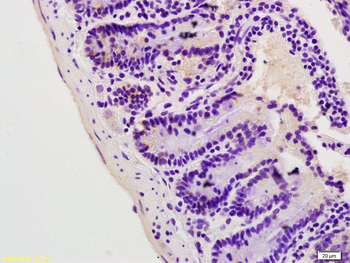 Lpin1 protein Rabbit Polyclonal Antibody