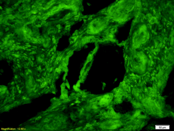 PKM2 Rabbit Polyclonal Antibody