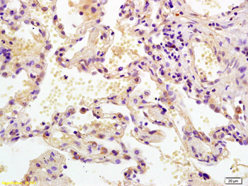 MEK2 Rabbit Polyclonal Antibody
