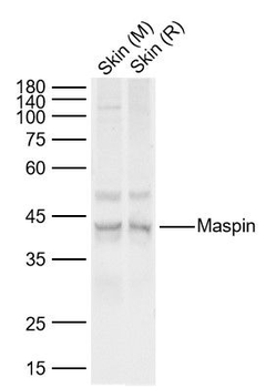 Maspin Rabbit Polyclonal Antibody