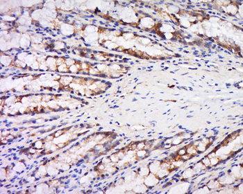 Maspin Rabbit Polyclonal Antibody