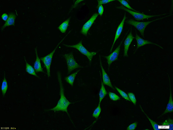 MDR1/P Glycoprotein Rabbit Polyclonal Antibody