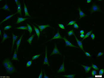 MDR1/P Glycoprotein Rabbit Polyclonal Antibody