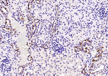 Megsin Rabbit Polyclonal Antibody