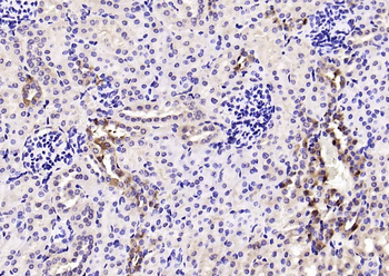 Megsin Rabbit Polyclonal Antibody