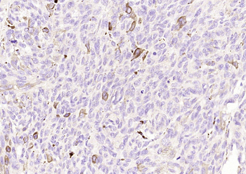 Melan A Rabbit Polyclonal Antibody
