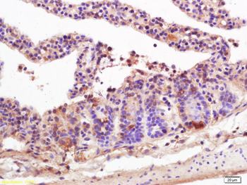 MICA Rabbit Polyclonal Antibody