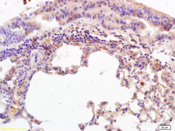 MICA Rabbit Polyclonal Antibody