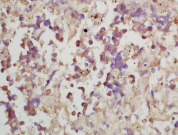 MMP10 Rabbit Polyclonal Antibody