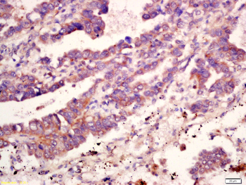 MMP10 Rabbit Polyclonal Antibody